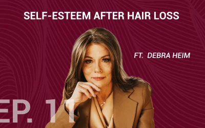 Self-Esteem After Hair Loss with Debra Heim